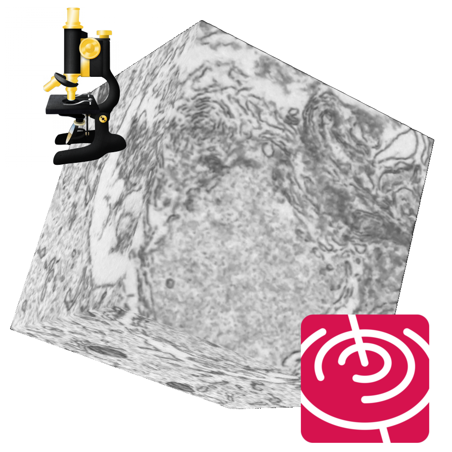 DenoisEM